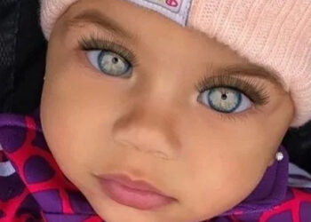 WOW! Sådan ser ‘verdens smukkeste pige’ ud i dag