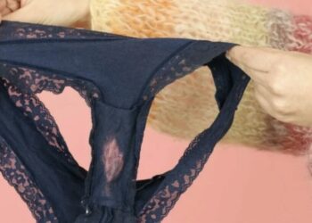 Sådan! Her kommer de blegpletter i dit undertøj fra