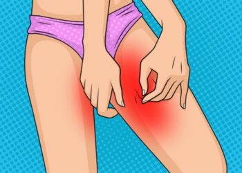 Undgå gnavende lår om sommeren med dette enkle trick